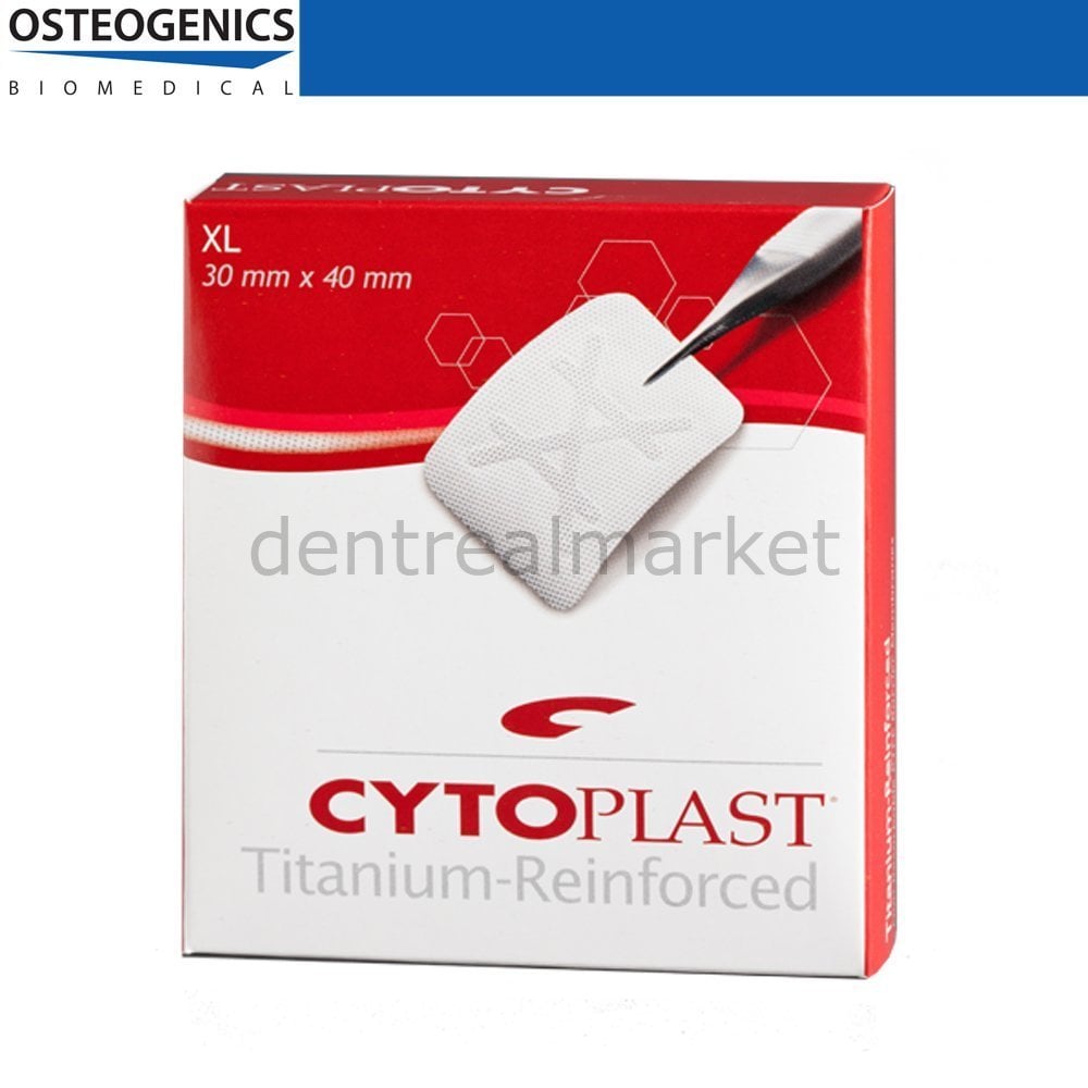 Cytoplast Titanyum Destekli Membran XL - 30x40 mm