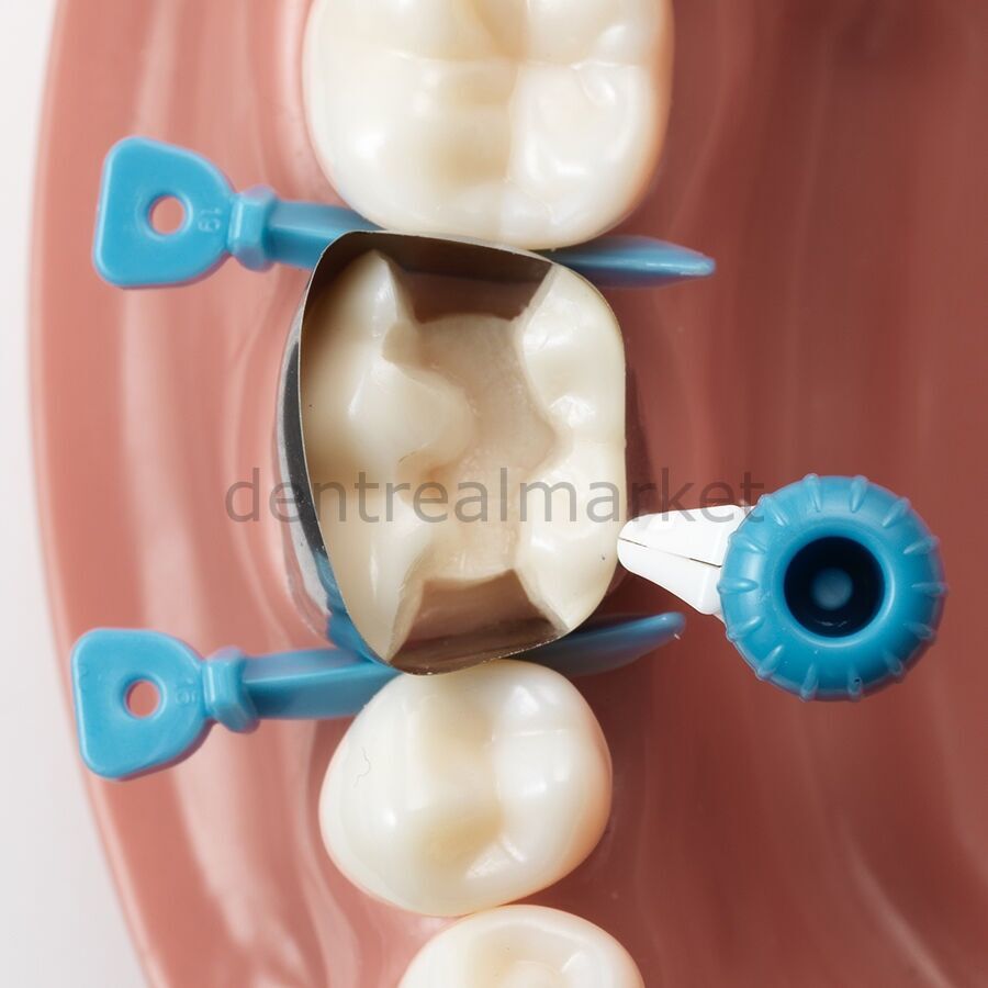 Palodent 360 Çevresel Matrix İntro Kit