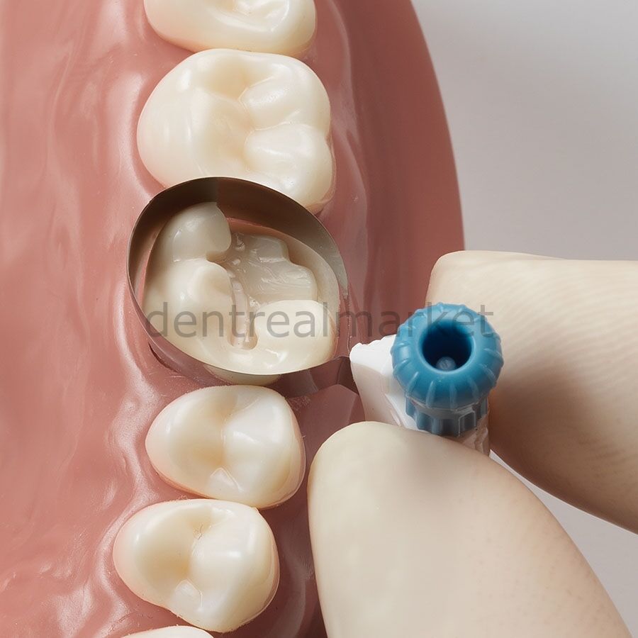 Palodent 360 Çevresel Matrix İntro Kit