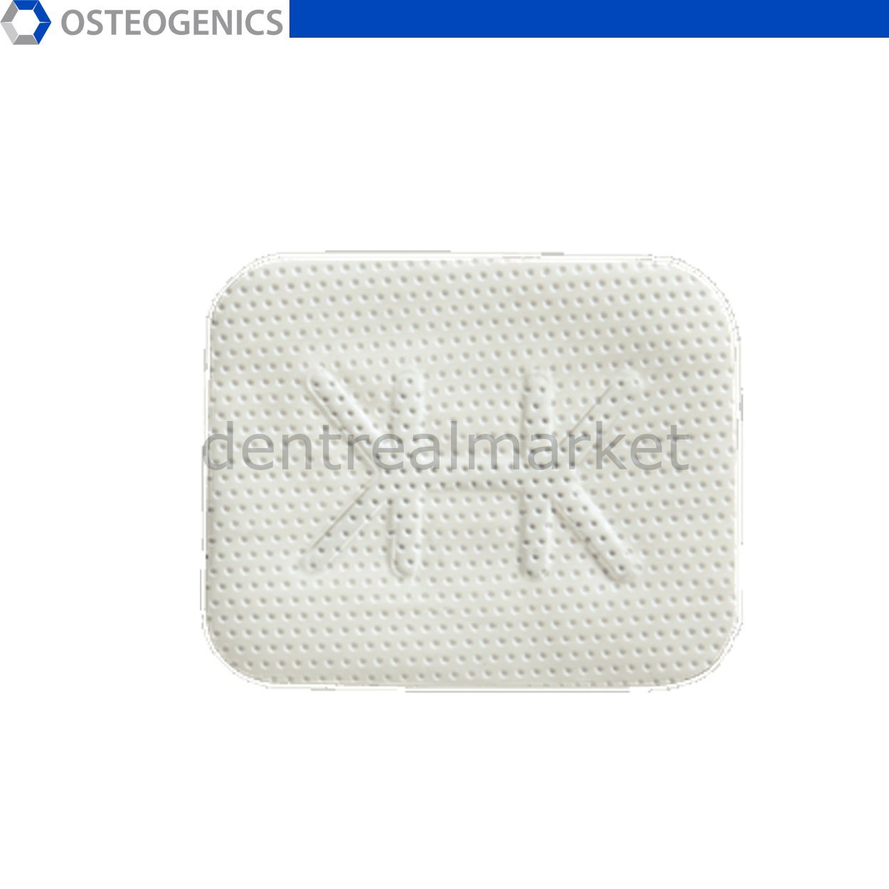 Cytoplast Titanyum Destekli Membran - 25x36 mm - Posterior T2