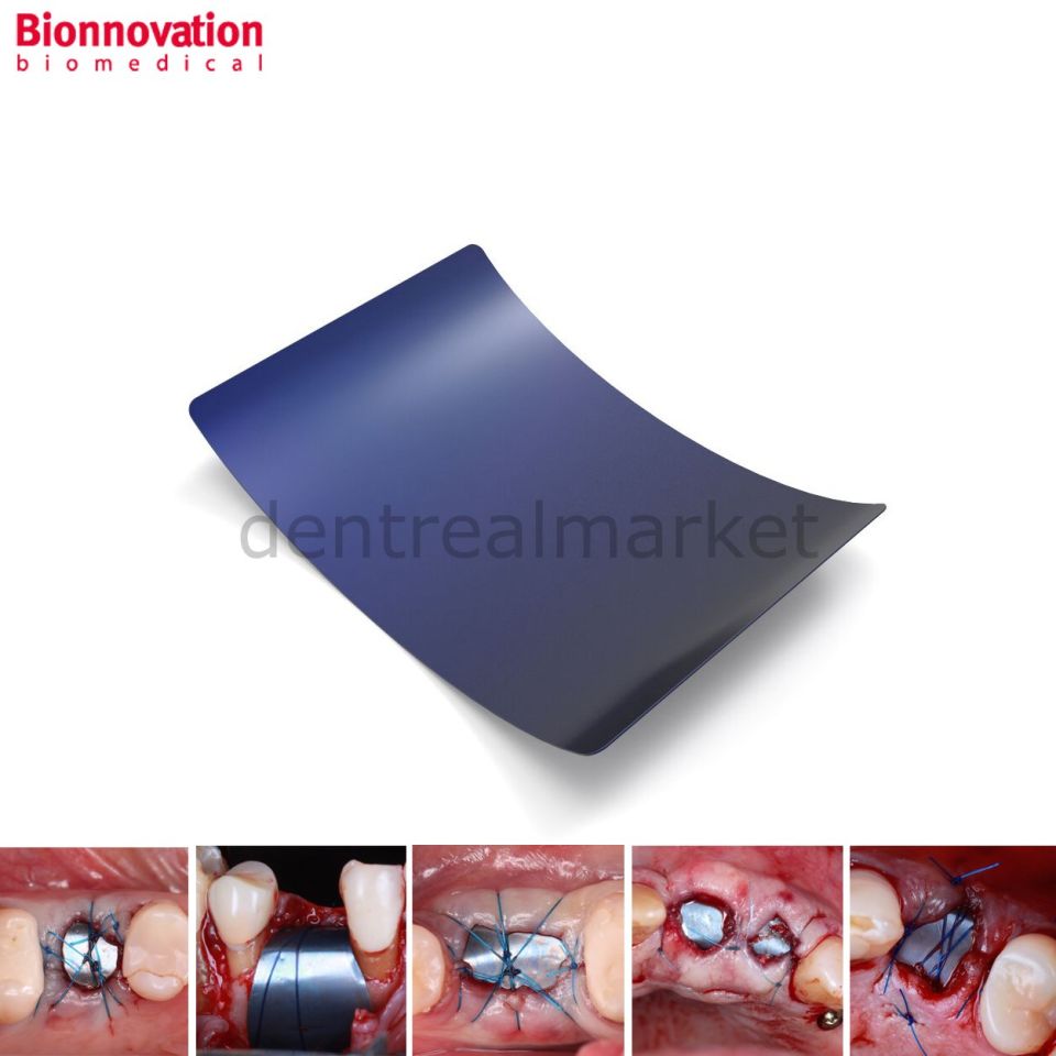 Surgitime Seal Titanium Mesh - Deliksiz - 34x25 mm Deliksiz