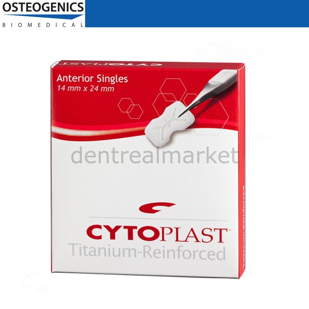 Cytoplast Titanyum Destekli Membran - Anterior Single -14x24 mm