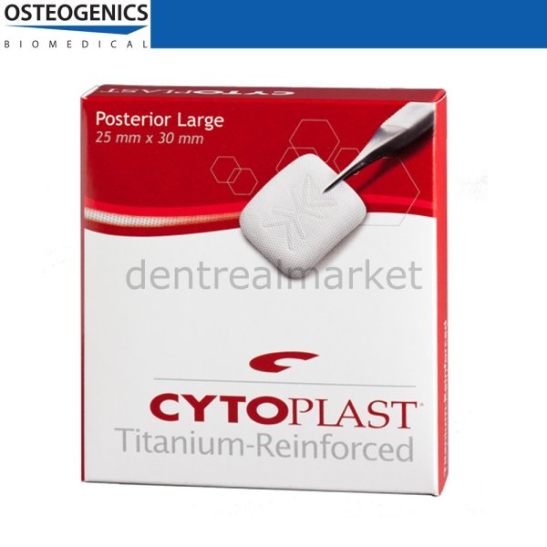 Cytoplast Titanyum Destekli Membran - 25x30 mm - Posterior