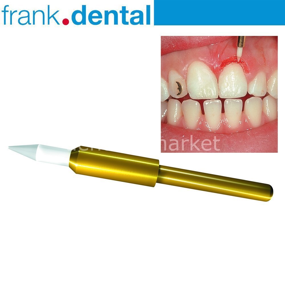 Gingiva Trimmer Yumuşak Doku Frezi - GT48L